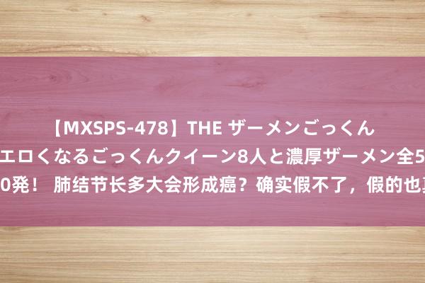 【MXSPS-478】THE ザーメンごっくん vol.2 飲めば飲むほどエロくなるごっくんクイーン8人と濃厚ザーメン全50発！ 肺结节长多大会形成癌？确实假不了，假的也真不了！一定要抽象来判断。